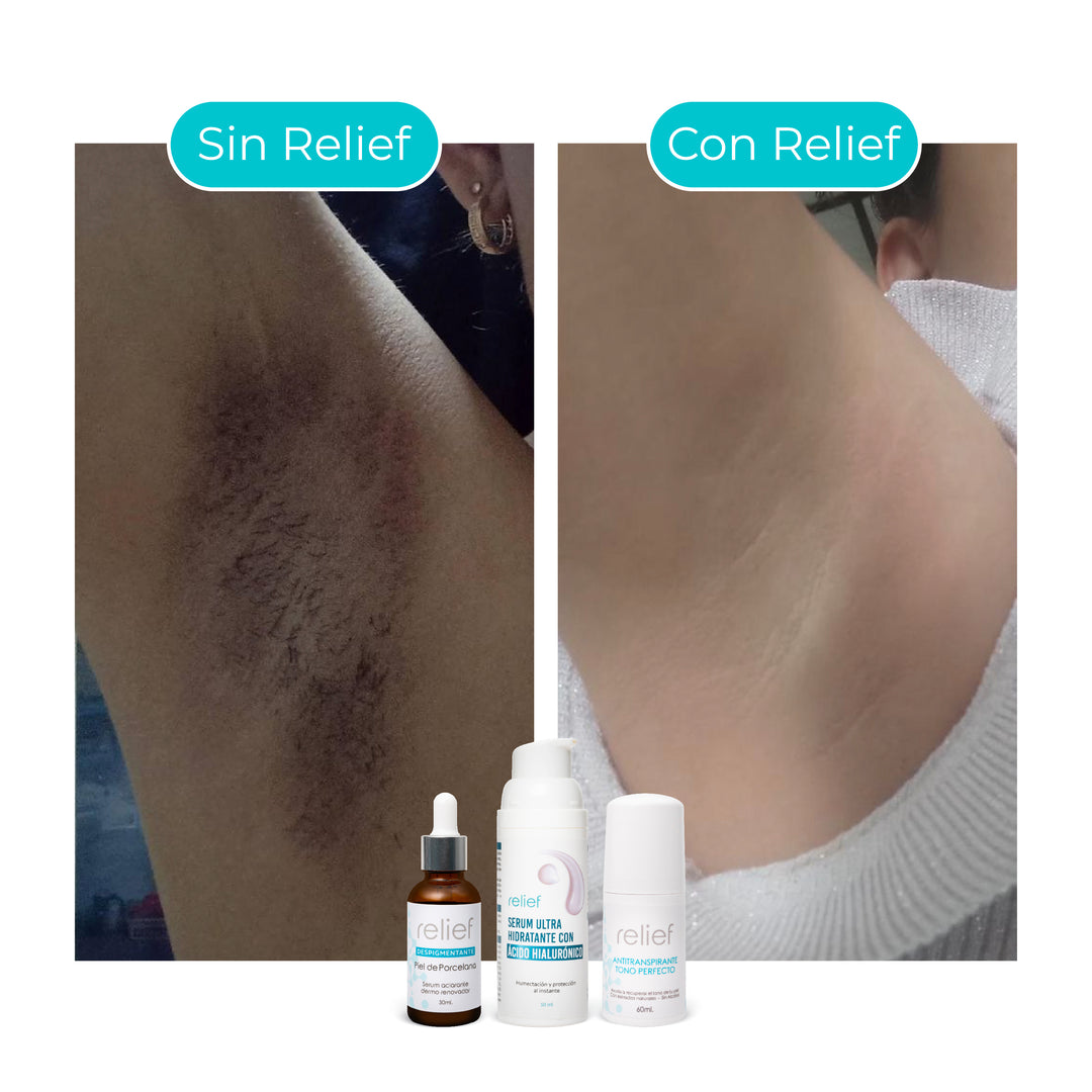 KIT AXILAS PERFECTAS: Serum Hidratante , Despigmentante y Antitranspirante