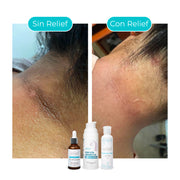 KIT ANTIMANCHAS: Serum Hidratante, Protector Solar y Despigmentante