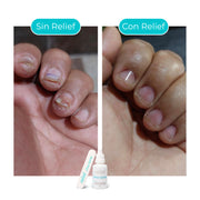 UÑAS SANAS: GOTAS PARA ELIMINAR HONGOS EN LAS UÑAS