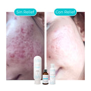 KIT ANTIACNÉ: Reduce brotes y difumina manchas
