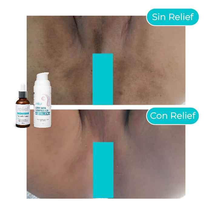 KIT ZONAS INTIMAS: Serum Hidratante y Despigmentante