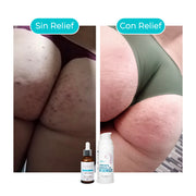 KIT ZONAS INTIMAS: Serum Hidratante y Despigmentante