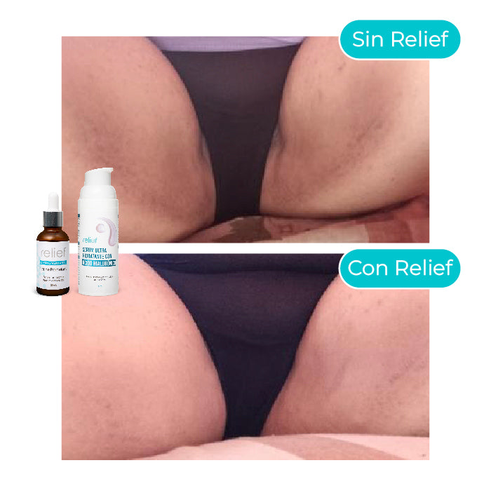 KIT ZONAS INTIMAS: Serum Hidratante y Despigmentante