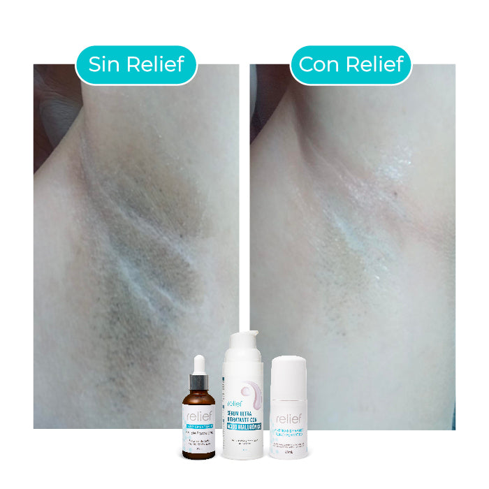 KIT AXILAS PERFECTAS: Serum Hidratante , Despigmentante y Antitranspirante