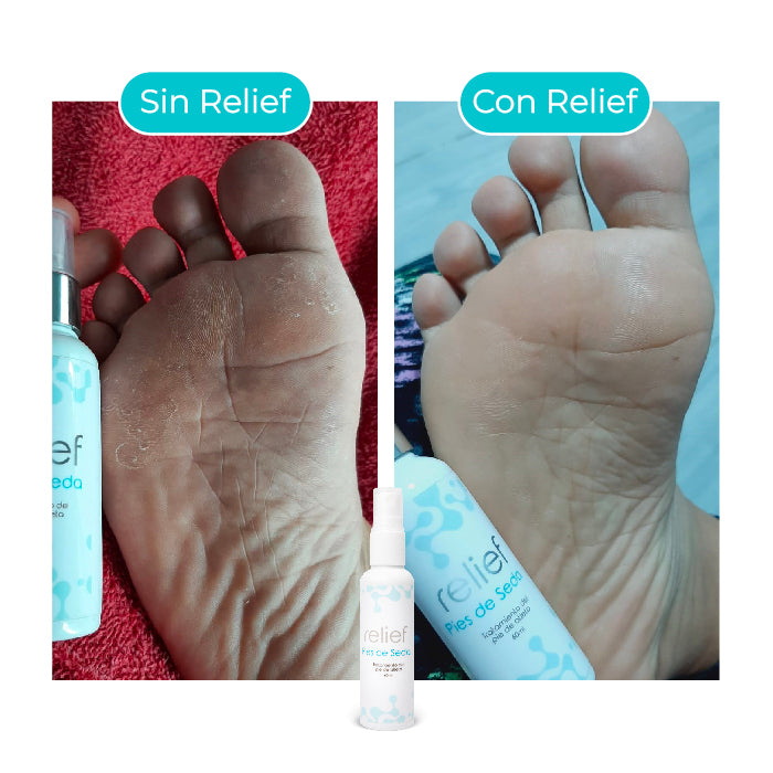 COMBO UÑAS Y PIES: Tratamiento para la Onicomicosis