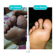 PIES DE SEDA: Elimina Hongos, Mal Olor y Pie de Atleta