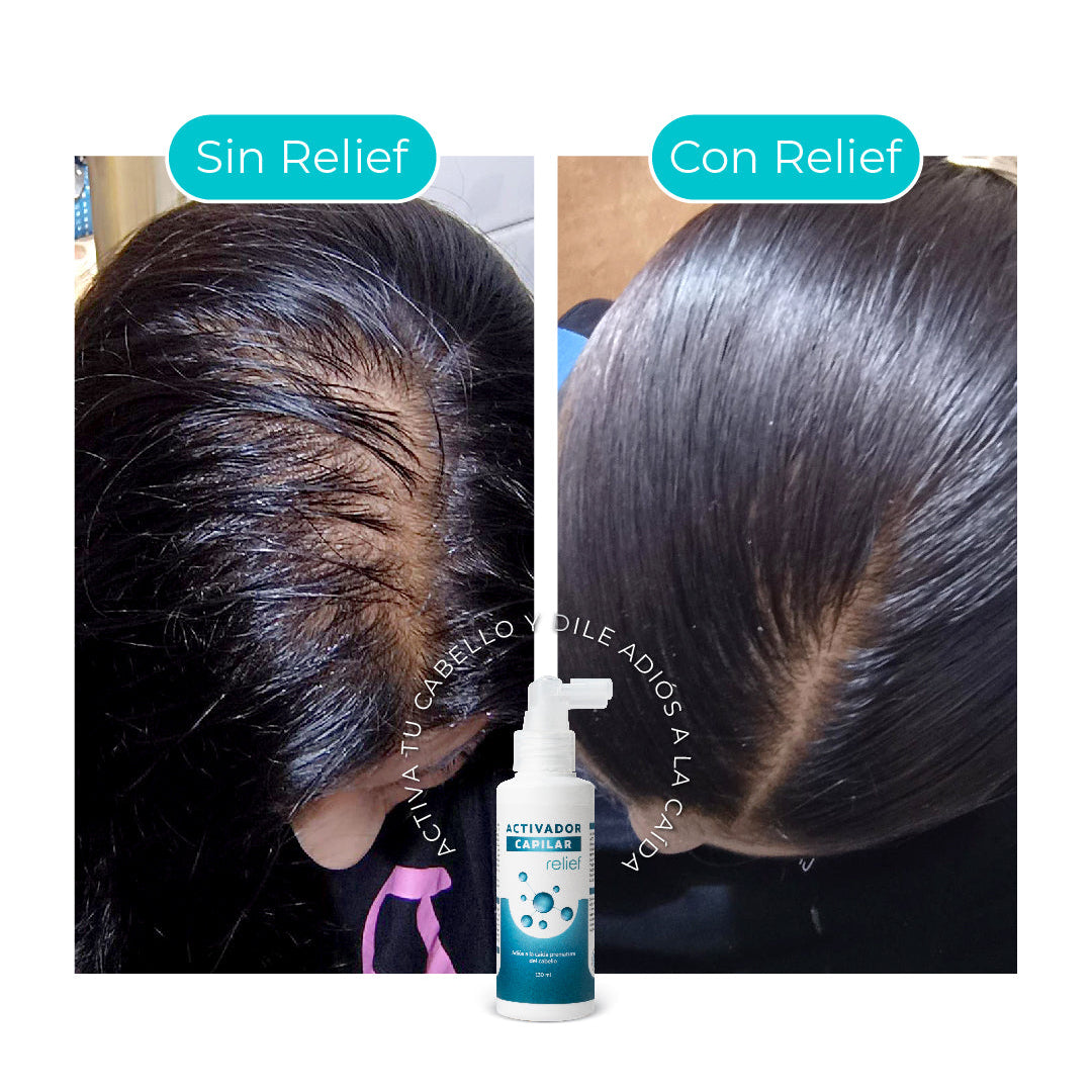ACTIVADOR CAPILAR PARA EL CRECIMIENTO DEL CABELLO