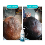 Cargue la imagen en el visor de la galería, ACTIVADOR CAPILAR PARA EL CRECIMIENTO DEL CABELLO

