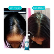 ACTIVADOR CAPILAR PARA EL CRECIMIENTO DEL CABELLO