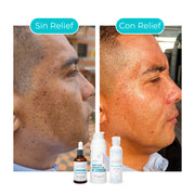 DESPIGMENTANTE DE PIEL: Piel de Porcelana